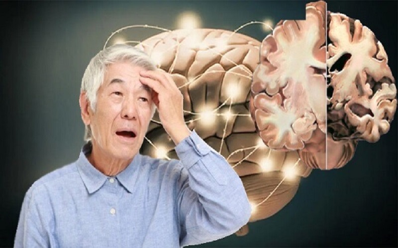 nguyên nhân nào gây suy giảm trí nhớ ở người lớn tuổi